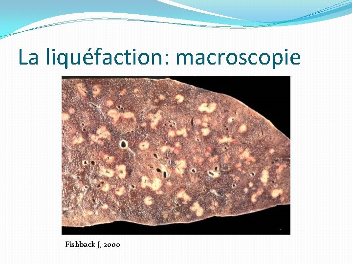 La liquéfaction: macroscopie Fishback J, 2000 