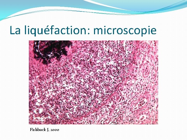 La liquéfaction: microscopie Fishback J, 2000 