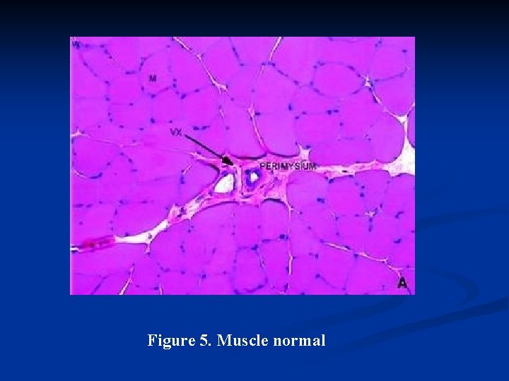 Figure 5. Muscle normal 