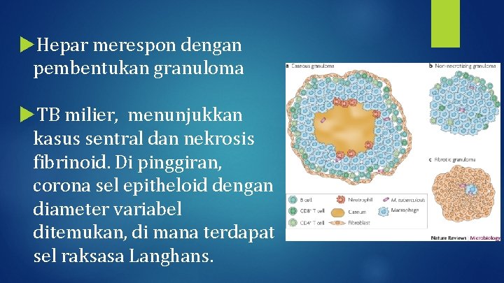  Hepar merespon dengan pembentukan granuloma TB milier, menunjukkan kasus sentral dan nekrosis fibrinoid.