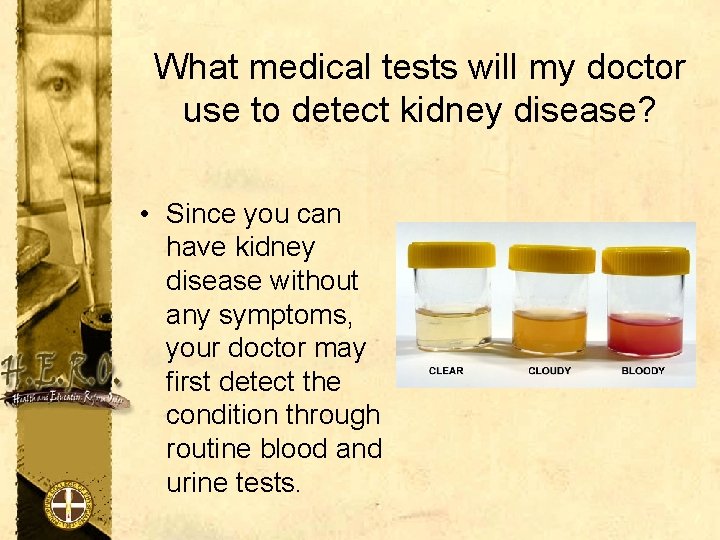 What medical tests will my doctor use to detect kidney disease? • Since you