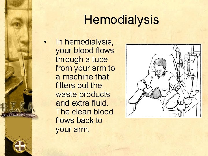 Hemodialysis • In hemodialysis, your blood flows through a tube from your arm to