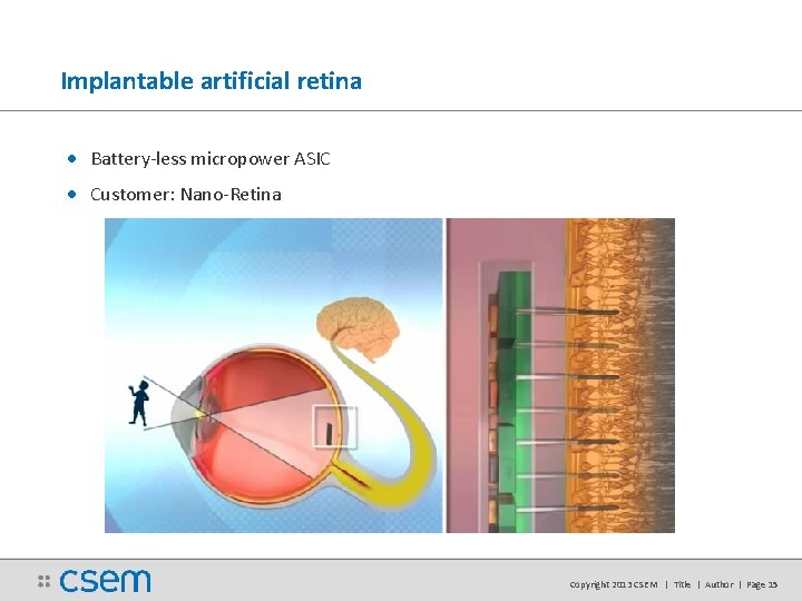 Implantable artificial retina • Battery-less micropower ASIC • Customer: Nano-Retina Copyright 2013 CSEM | Implantable artificial retina • Battery-less micropower ASIC • Customer: Nano-Retina Copyright 2013 CSEM |