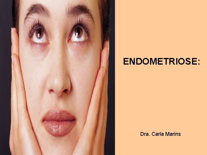 ENDOMETRIOSE: Dra. Carla Marins 