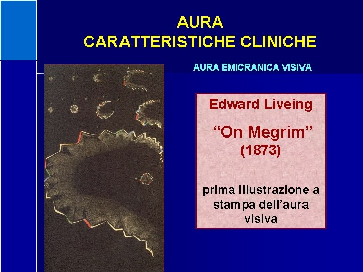 AURA CARATTERISTICHE CLINICHE AURA EMICRANICA VISIVA Edward Liveing “On Megrim” (1873) prima illustrazione a
