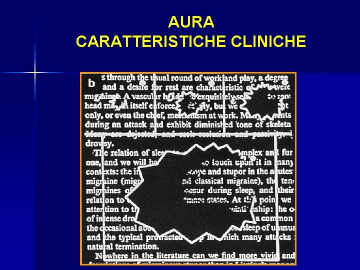 AURA CARATTERISTICHE CLINICHE 
