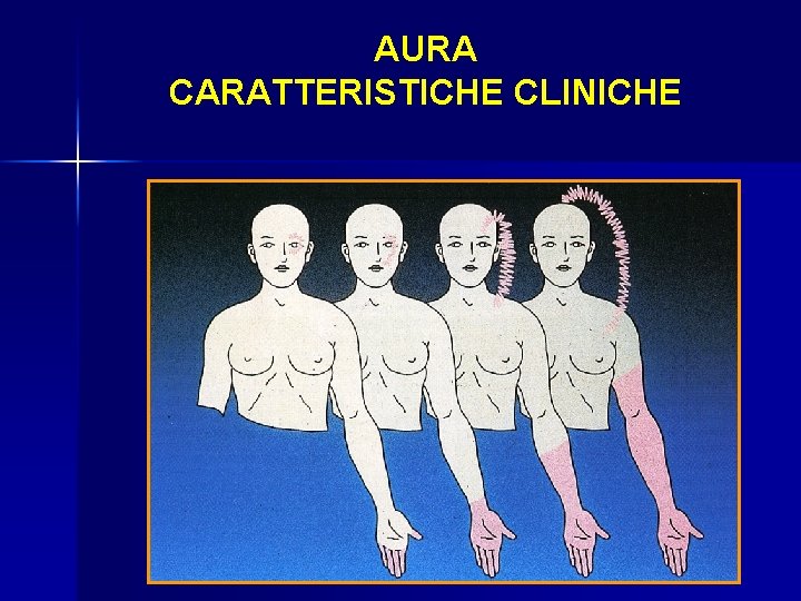 AURA CARATTERISTICHE CLINICHE 