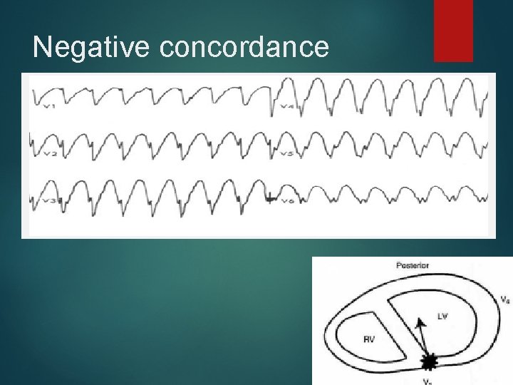 Negative concordance 