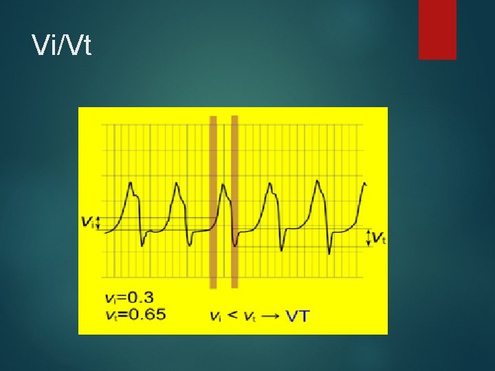 Vi/Vt 