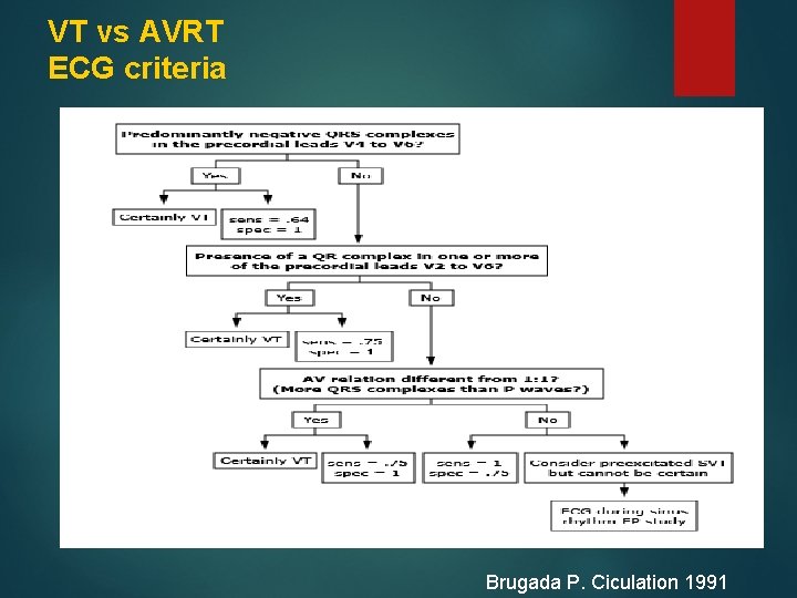 VT vs AVRT ECG criteria Brugada P. Ciculation 1991 