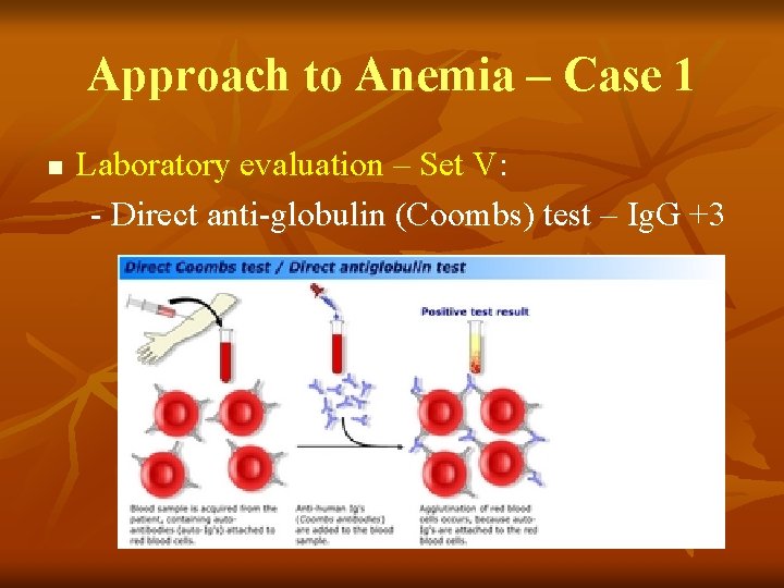 Approach to Anemia – Case 1 n Laboratory evaluation – Set V: - Direct