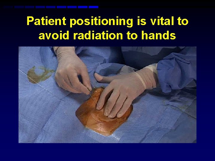 Patient positioning is vital to avoid radiation to hands Patient positioning is vital to avoid radiation to hands