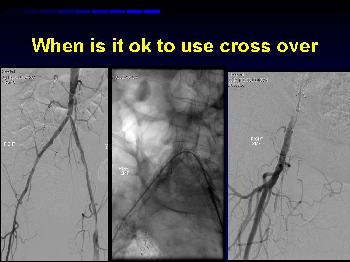 When is it ok to use cross over When is it ok to use cross over