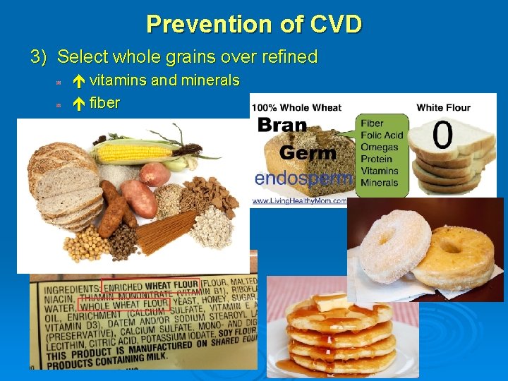 Prevention of CVD 3) Select whole grains over refined vitamins and minerals fiber 