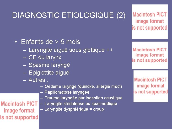 DIAGNOSTIC ETIOLOGIQUE (2) • Enfants de > 6 mois – – – Laryngite aiguë DIAGNOSTIC ETIOLOGIQUE (2) • Enfants de > 6 mois – – – Laryngite aiguë