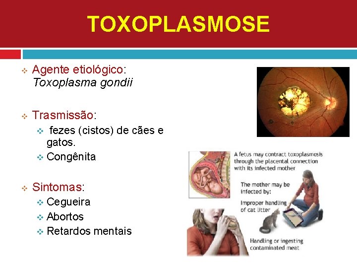 TOXOPLASMOSE v v Agente etiológico: Toxoplasma gondii Trasmissão: fezes (cistos) de cães e gatos.