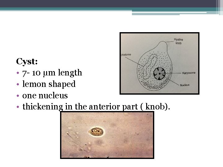 Cyst: • 7 - 10 μm length • lemon shaped • one nucleus •