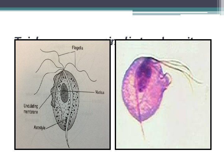 Trichomonas vaginalis trophozoite 