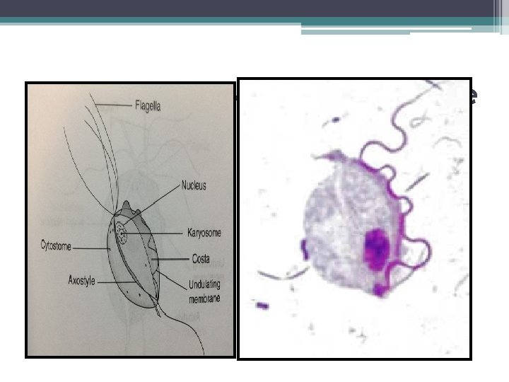 Trichomonas hominis tropozoite 