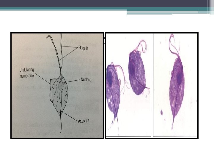 Trichomonas tenax tropozoite 