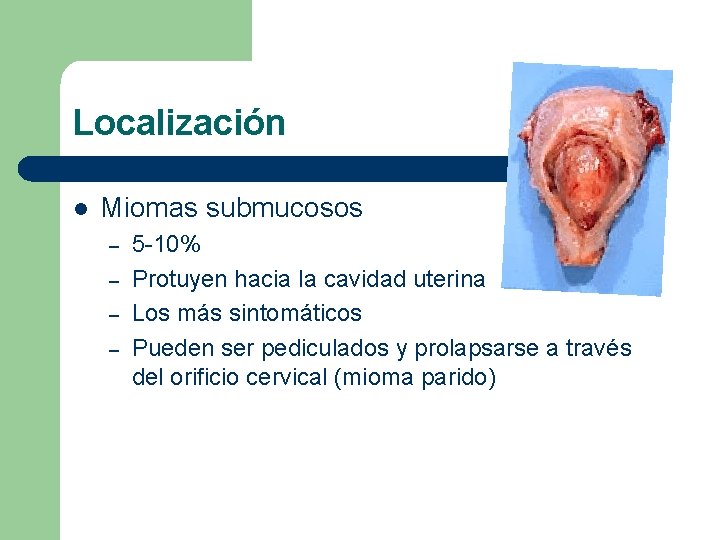 Localización l Miomas submucosos – – 5 -10% Protuyen hacia la cavidad uterina Los