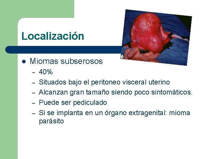 Localización l Miomas subserosos – – – 40% Situados bajo el peritoneo visceral uterino