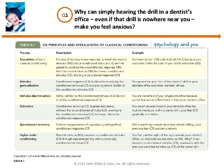 Q 1 Why can simply hearing the drill in a dentist’s office – even