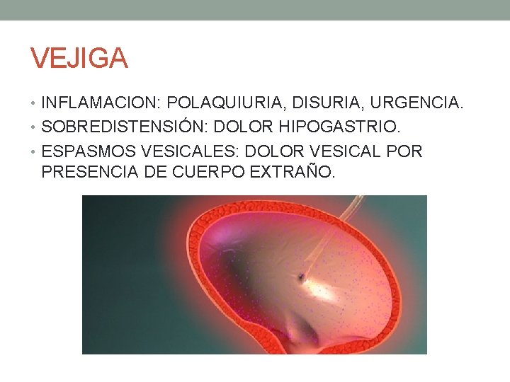 VEJIGA • INFLAMACION: POLAQUIURIA, DISURIA, URGENCIA. • SOBREDISTENSIÓN: DOLOR HIPOGASTRIO. • ESPASMOS VESICALES: DOLOR VEJIGA • INFLAMACION: POLAQUIURIA, DISURIA, URGENCIA. • SOBREDISTENSIÓN: DOLOR HIPOGASTRIO. • ESPASMOS VESICALES: DOLOR
