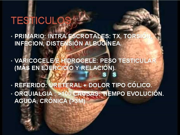 TESTICULOS • PRIMARIO: INTRA ESCROTALES: TX, TORSIÓN, INFECION, DISTENSIÓN ALBUGÍNEA. • VARICOCELE E HIDROCELE: TESTICULOS • PRIMARIO: INTRA ESCROTALES: TX, TORSIÓN, INFECION, DISTENSIÓN ALBUGÍNEA. • VARICOCELE E HIDROCELE: