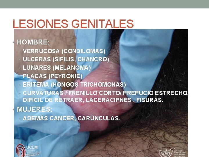 LESIONES GENITALES • HOMBRE: • VERRUCOSA (CONDILOMAS) • ULCERAS (SÍFILIS, CHANCRO) • LUNARES (MELANOMA) LESIONES GENITALES • HOMBRE: • VERRUCOSA (CONDILOMAS) • ULCERAS (SÍFILIS, CHANCRO) • LUNARES (MELANOMA)