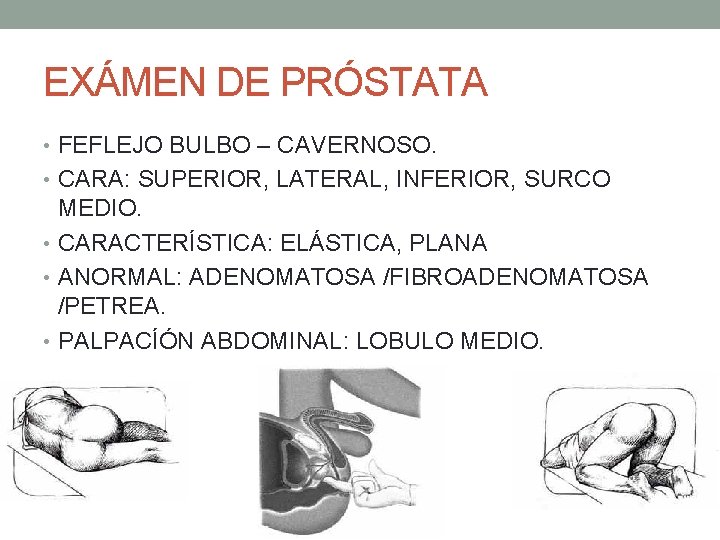 EXÁMEN DE PRÓSTATA • FEFLEJO BULBO – CAVERNOSO. • CARA: SUPERIOR, LATERAL, INFERIOR, SURCO EXÁMEN DE PRÓSTATA • FEFLEJO BULBO – CAVERNOSO. • CARA: SUPERIOR, LATERAL, INFERIOR, SURCO