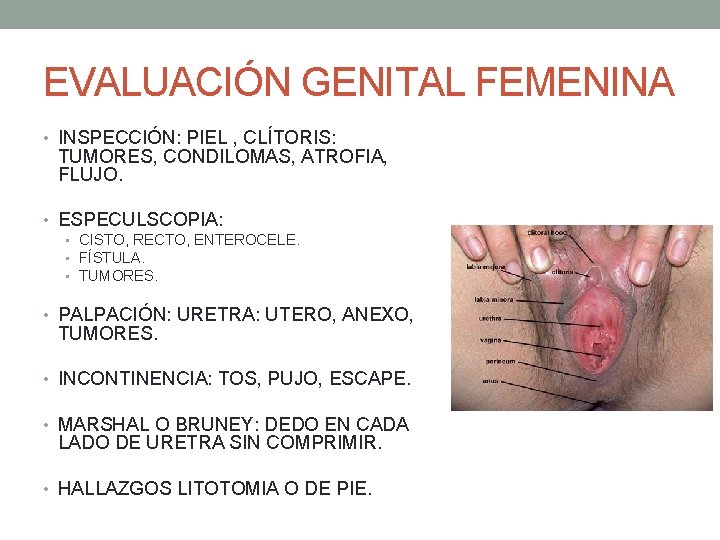 EVALUACIÓN GENITAL FEMENINA • INSPECCIÓN: PIEL , CLÍTORIS: TUMORES, CONDILOMAS, ATROFIA, FLUJO. • ESPECULSCOPIA: EVALUACIÓN GENITAL FEMENINA • INSPECCIÓN: PIEL , CLÍTORIS: TUMORES, CONDILOMAS, ATROFIA, FLUJO. • ESPECULSCOPIA: