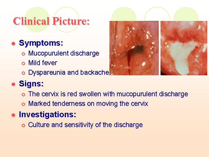 Clinical Picture: l Symptoms: ¡ ¡ ¡ l Signs: ¡ ¡ l Mucopurulent discharge Clinical Picture: l Symptoms: ¡ ¡ ¡ l Signs: ¡ ¡ l Mucopurulent discharge