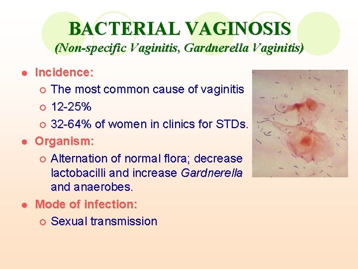 BACTERIAL VAGINOSIS (Non-specific Vaginitis, Gardnerella Vaginitis) l l l Incidence: ¡ The most common BACTERIAL VAGINOSIS (Non-specific Vaginitis, Gardnerella Vaginitis) l l l Incidence: ¡ The most common