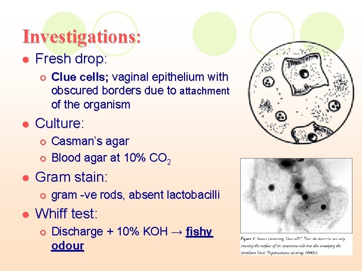 Investigations: l Fresh drop: ¡ l Culture: ¡ ¡ l Casman’s agar Blood agar Investigations: l Fresh drop: ¡ l Culture: ¡ ¡ l Casman’s agar Blood agar