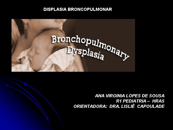DISPLASIA BRONCOPULMONAR ANA VIRGINIA LOPES DE SOUSA R 1 PEDIATRIA – HRAS ORIENTADORA: DRA.