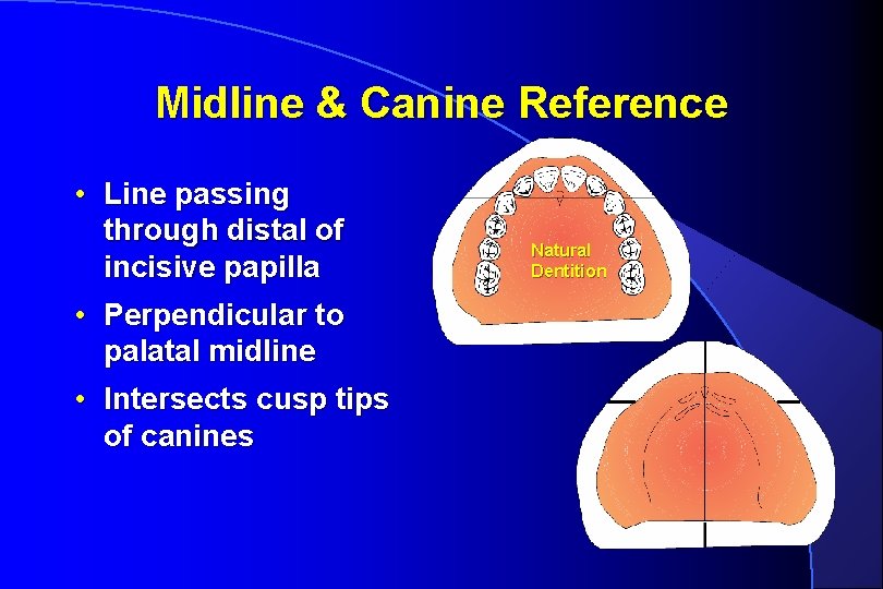 Midline & Canine Reference • Line passing through distal of incisive papilla • Perpendicular