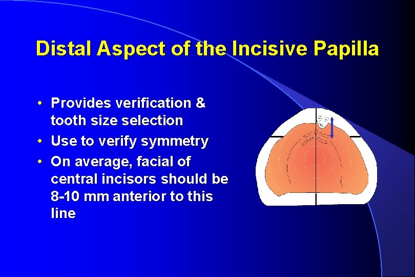 Distal Aspect of the Incisive Papilla • Provides verification & tooth size selection •