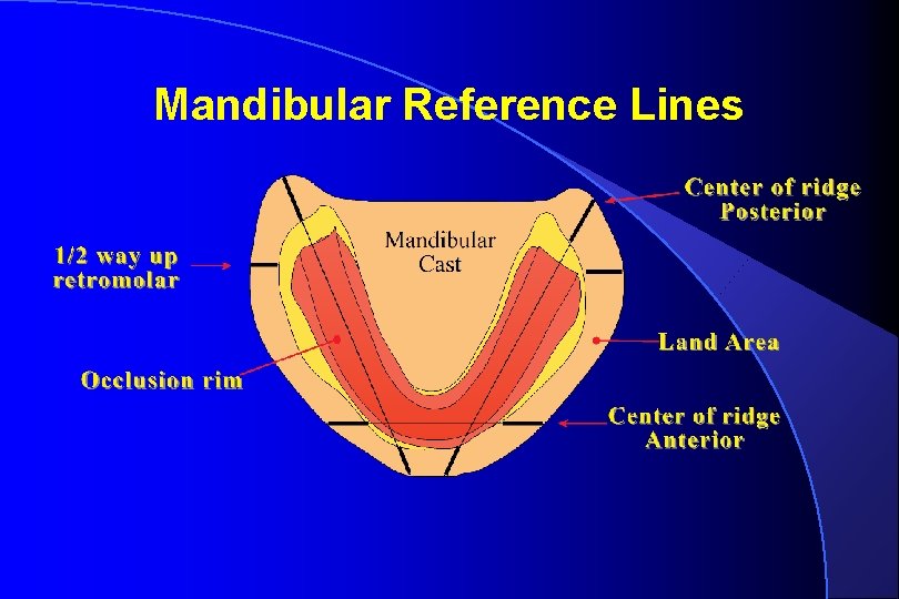 Mandibular Reference Lines 