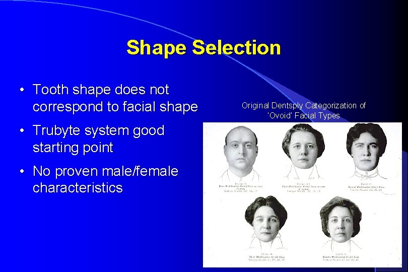 Shape Selection • Tooth shape does not correspond to facial shape • Trubyte system