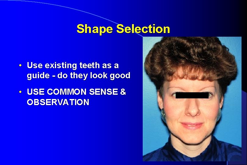 Shape Selection • Use existing teeth as a guide - do they look good