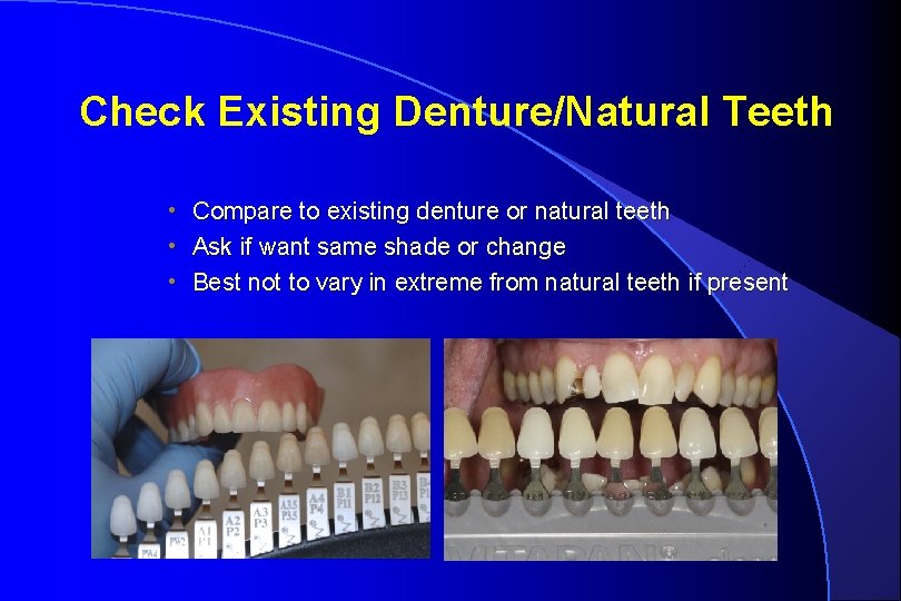 Check Existing Denture/Natural Teeth • Compare to existing denture or natural teeth • Ask