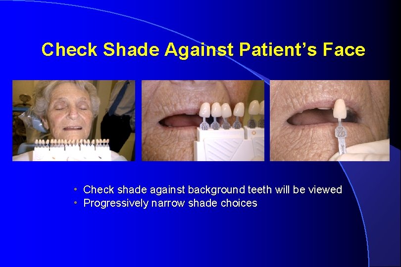 Check Shade Against Patient’s Face • Check shade against background teeth will be viewed