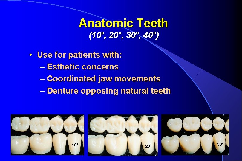 Anatomic Teeth (10°, 20°, 30°, 40°) • Use for patients with: – Esthetic concerns