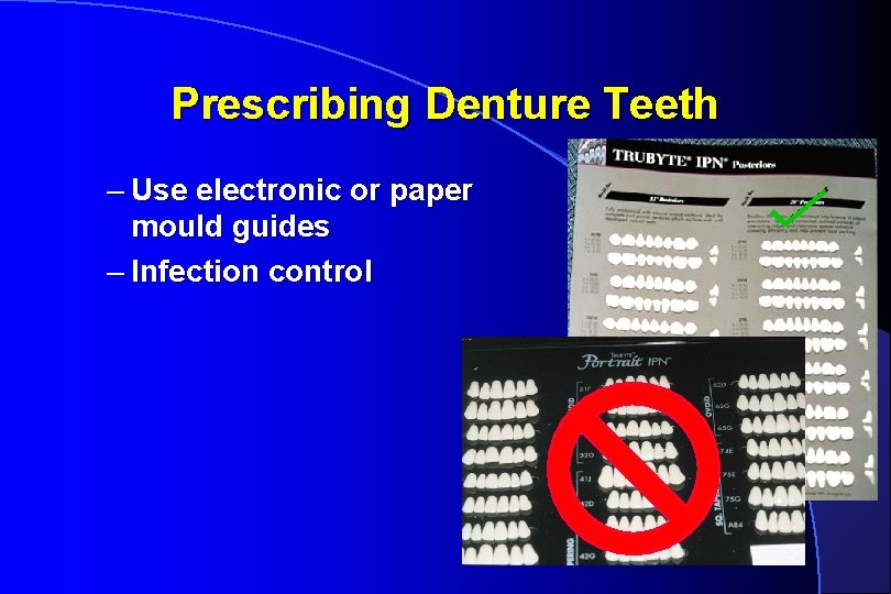 Prescribing Denture Teeth – Use electronic or paper mould guides – Infection control 