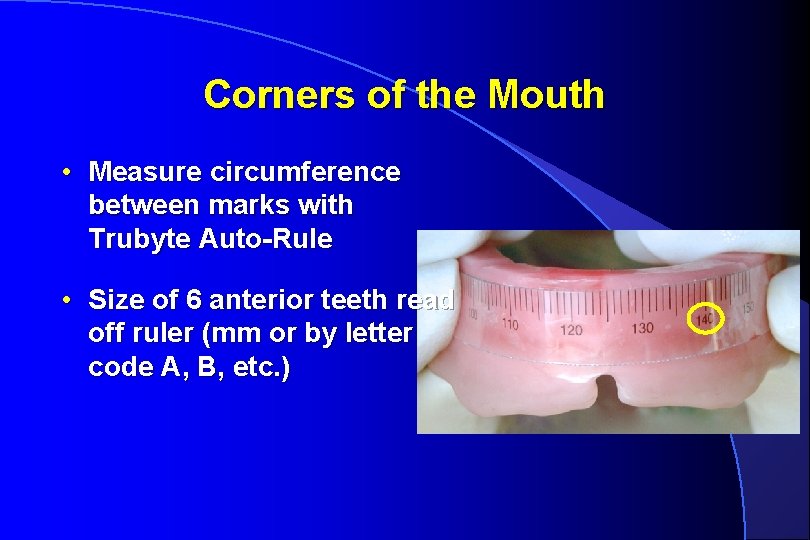 Corners of the Mouth • Measure circumference between marks with Trubyte Auto-Rule • Size