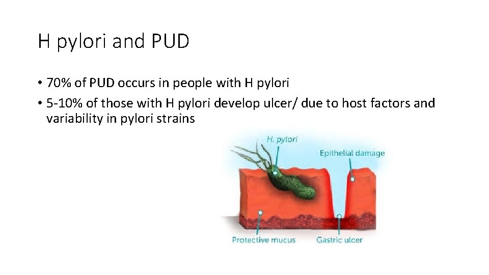 H pylori and PUD • 70% of PUD occurs in people with H pylori