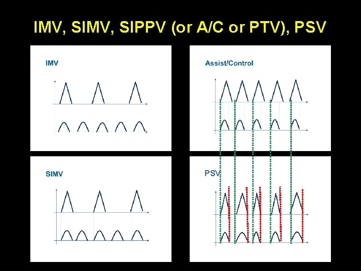 IMV, SIPPV (or A/C or PTV), PSV 