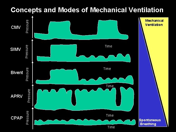 Concepts and Modes of Mechanical Ventilation Bivent Pressure SIMV Pressure CMV Mechanical Ventilation Time