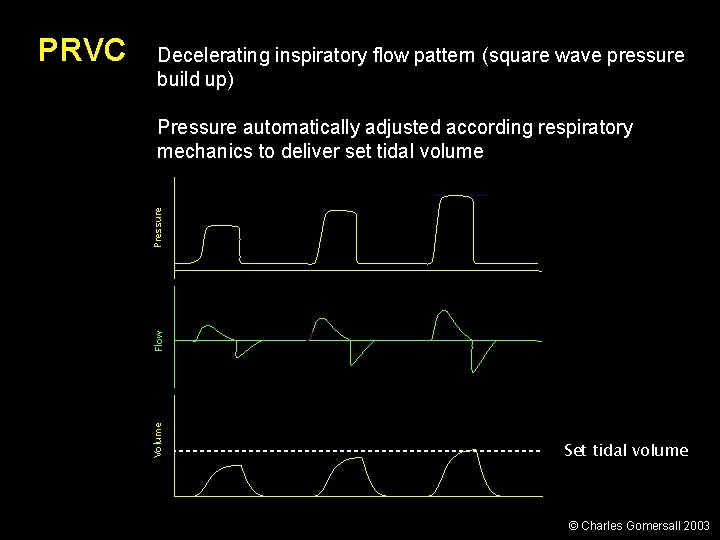 Decelerating inspiratory flow pattern (square wave pressure build up) Flow Pressure automatically adjusted according